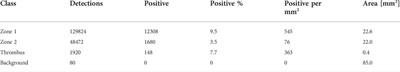 Artificial intelligence assisted compositional analyses of human abdominal aortic aneurysms ex vivo